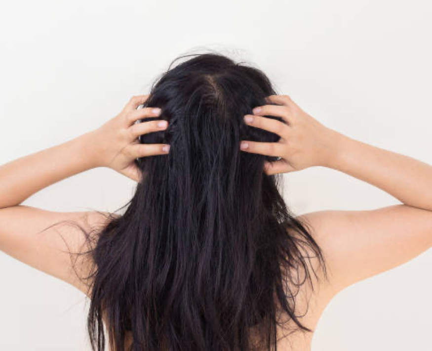 Prečo vlasy nerastú_GR7.SK
