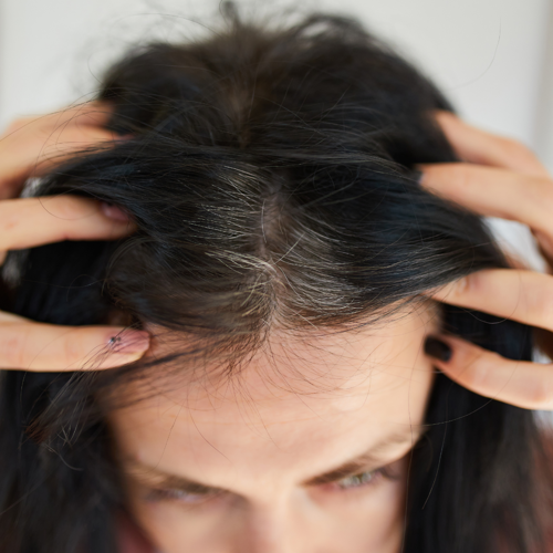 Dá sa starnutie vlasov spomaliť? Dá sa starnutie vlasov spomaliť?