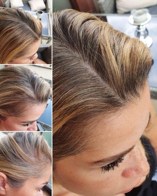 Pred a po GR-7 tonikum proti šedinám