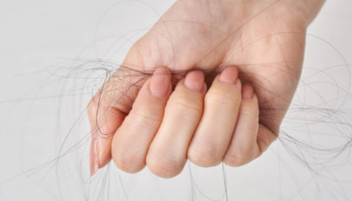 Prečo vlasy nerastú, aj keď používaš kozmetiku na rast